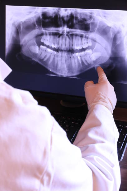 Best Urgent Care for Lost Fillings or Crowns in Miles, TX
